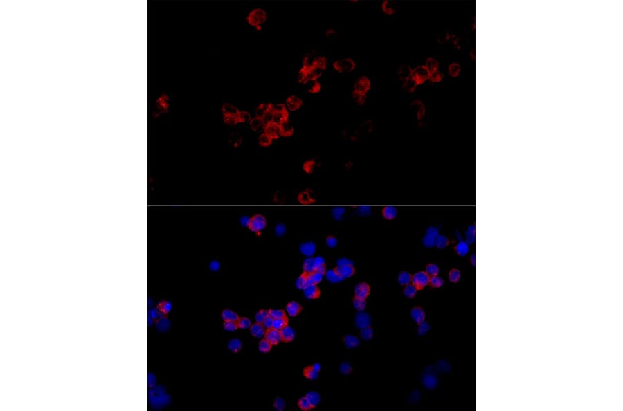 Immunofluorescence - Anti-DC-SIGNR Antibody (A89986) - Antibodies.com