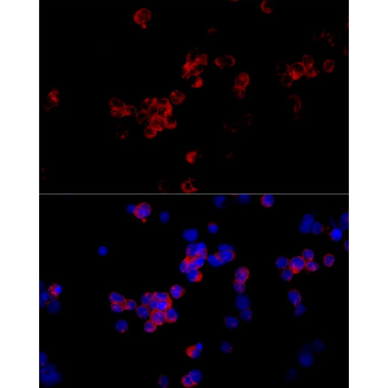 Immunofluorescence - Anti-DC-SIGNR Antibody (A89986) - Antibodies.com