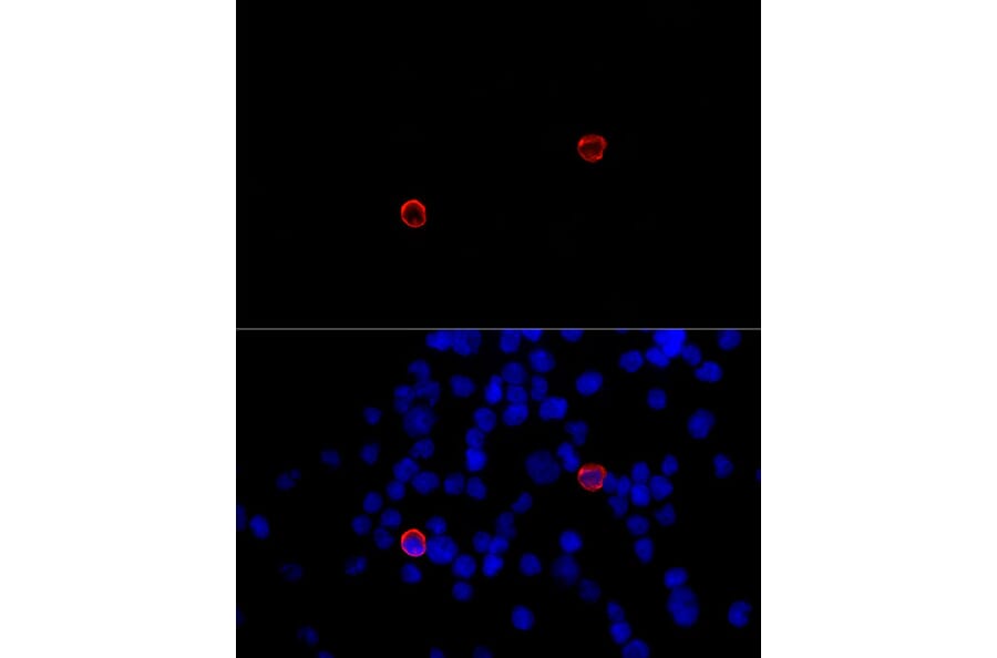 Immunofluorescence - Anti-DC-SIGNR Antibody (A89986) - Antibodies.com