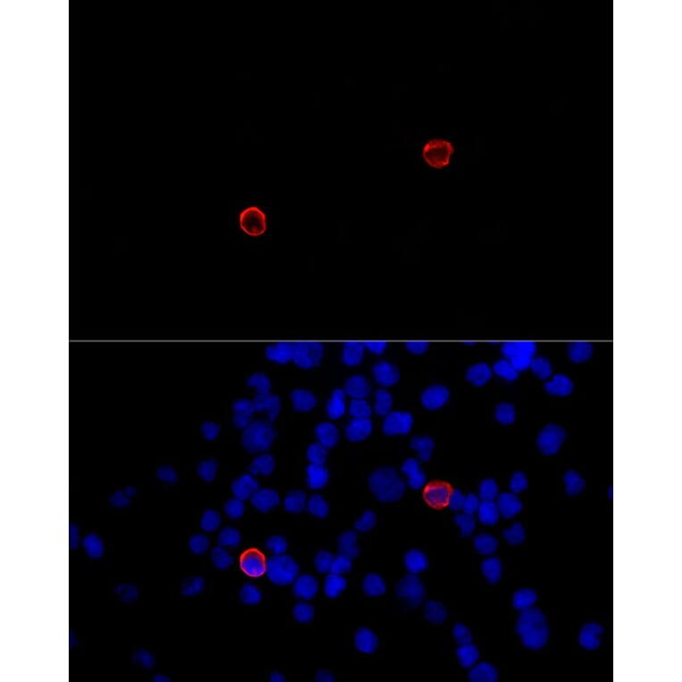 Immunofluorescence - Anti-DC-SIGNR Antibody (A89986) - Antibodies.com
