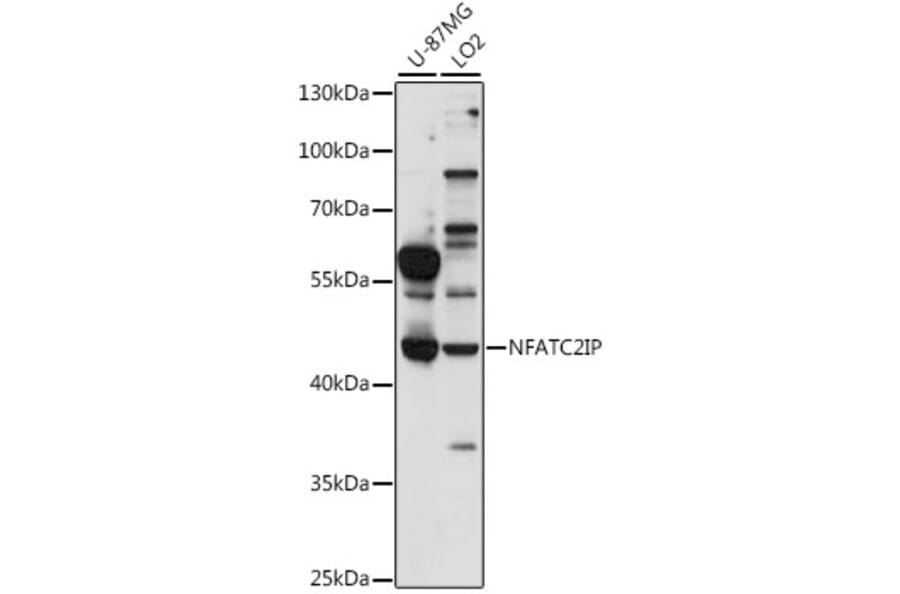 Western Blot - Anti-NFATC2IP Antibody (A89987) - Antibodies.com