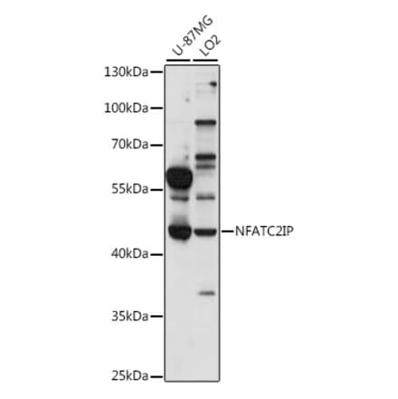 Western Blot - Anti-NFATC2IP Antibody (A89987) - Antibodies.com