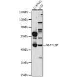 Western Blot - Anti-NFATC2IP Antibody (A89987) - Antibodies.com