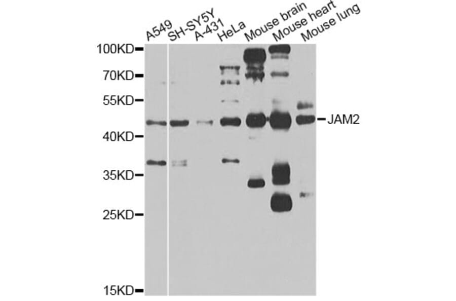 Western Blot - Anti-JAM2 Antibody (A14145) - Antibodies.com