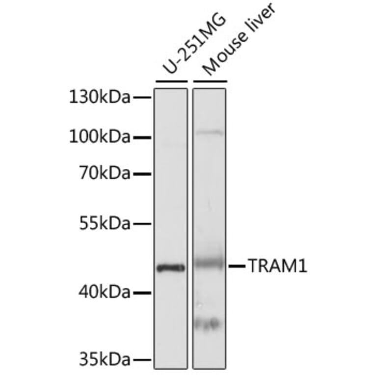 Western Blot - Anti-TRAM1/TRAM Antibody (A89989) - Antibodies.com