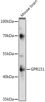 Western blot analysis of extracts of various cell lines, using Anti-GPR151 Antibody (A16165) at 1:1,000 dilution.
Secondary antibody: Goat Anti-Rabbit IgG (H+L) (HRP) (AS014) at 1:10,000 dilution.
Lysates / proteins: 25µg per lane.
Blocking buffer: 3% non-fat dry milk in TBST.
Detection: ECL Basic Kit (RM00020).
Exposure time: 90s.
