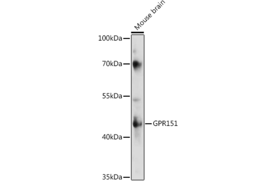 Western Blot - Anti-GPR151 Antibody (A89990) - Antibodies.com