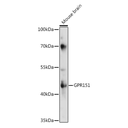Western Blot - Anti-GPR151 Antibody (A89990) - Antibodies.com
