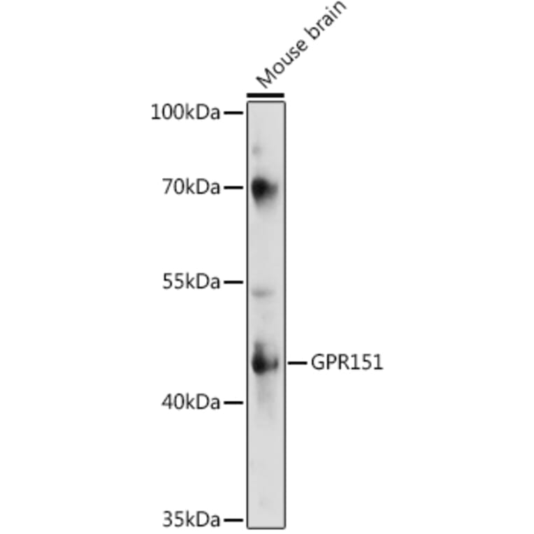 Western Blot - Anti-GPR151 Antibody (A89990) - Antibodies.com