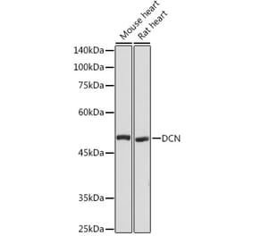 Western Blot - Anti-Decorin Antibody (A89991) - Antibodies.com