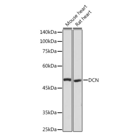 Western Blot - Anti-Decorin Antibody (A89991) - Antibodies.com
