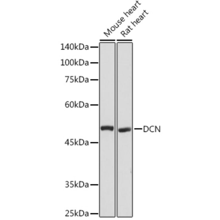 Western Blot - Anti-Decorin Antibody (A89991) - Antibodies.com