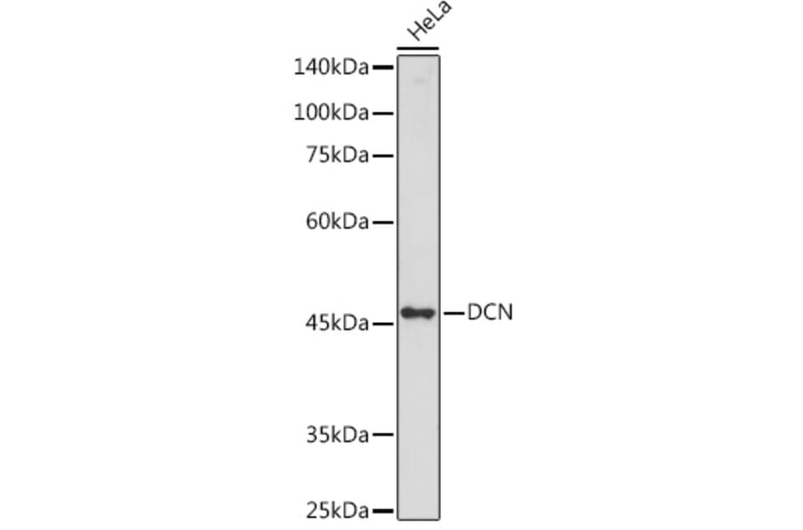 Western Blot - Anti-Decorin Antibody (A89991) - Antibodies.com