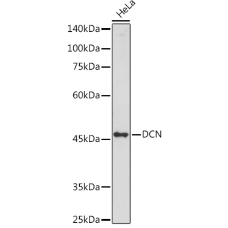 Western Blot - Anti-Decorin Antibody (A89991) - Antibodies.com