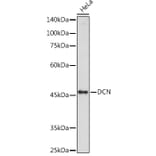 Western Blot - Anti-Decorin Antibody (A89991) - Antibodies.com