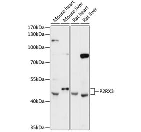 Western Blot - Anti-P2X3 Antibody (A89992) - Antibodies.com
