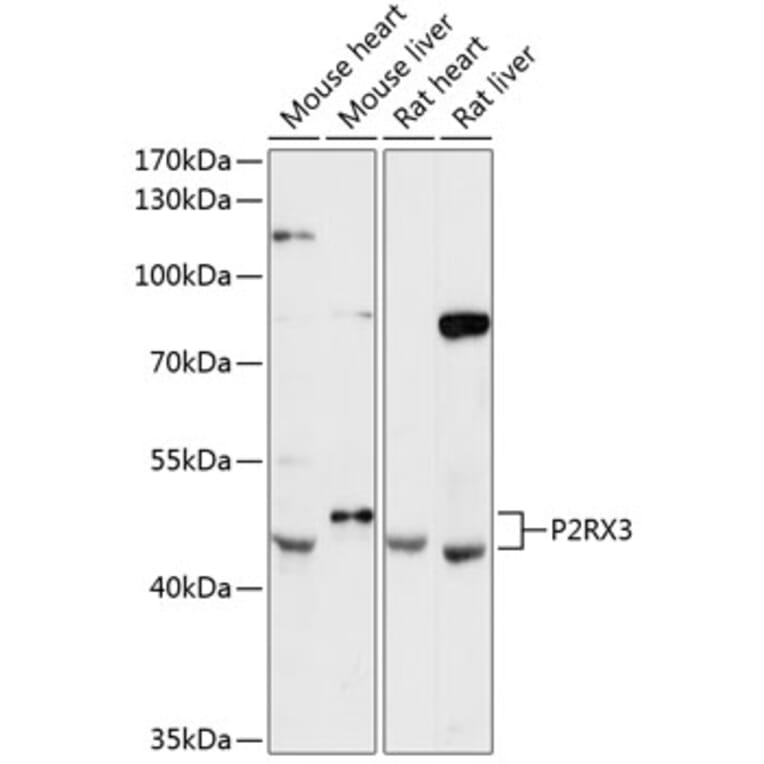 Western Blot - Anti-P2X3 Antibody (A89992) - Antibodies.com