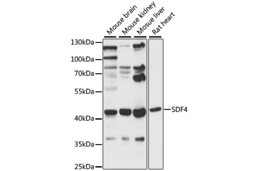 Western Blot - Anti-SDF4 Antibody (A89993) - Antibodies.com