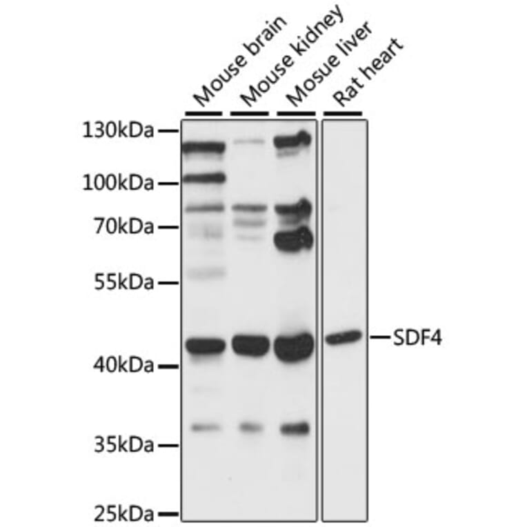 Western Blot - Anti-SDF4 Antibody (A89993) - Antibodies.com