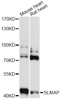 Western blot analysis of extracts of various cell lines, using Anti-SLMAP Antibody (A14367) at 1:3000 dilution.
Secondary antibody: Goat Anti-Rabbit IgG (H+L) (HRP) (AS014) at 1:10,000 dilution.
Lysates / proteins: 25µg per lane.
Blocking buffer: 3% non-fat dry milk in TBST.
Detection: ECL Basic Kit (RM00020).
Exposure time: 30s.