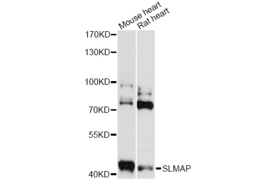 Western Blot - Anti-SLMAP Antibody (A14367) - Antibodies.com