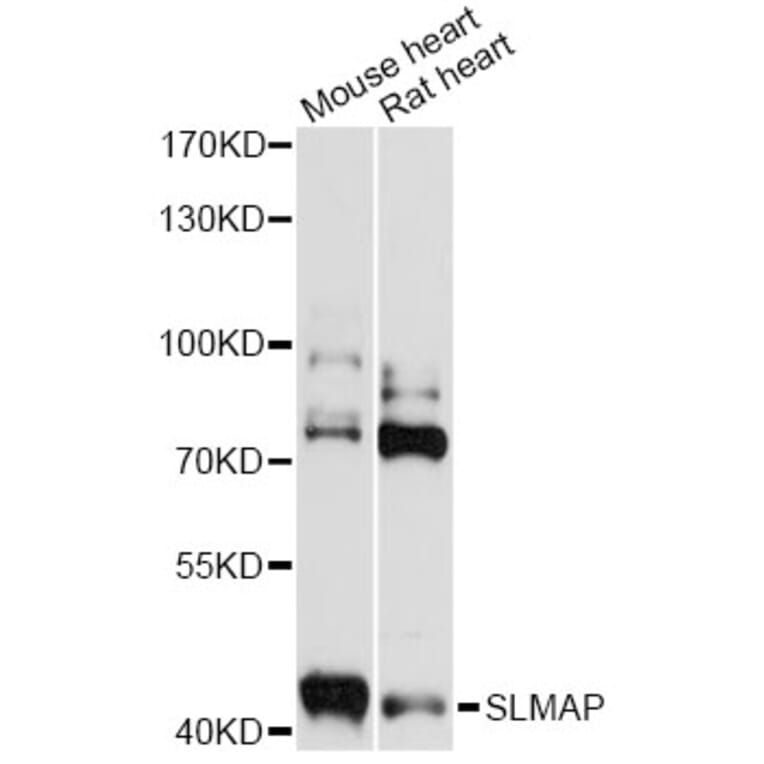 Western Blot - Anti-SLMAP Antibody (A14367) - Antibodies.com