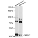 Western Blot - Anti-SLMAP Antibody (A14367) - Antibodies.com