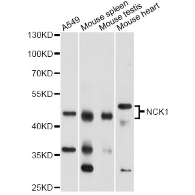 Western Blot - Anti-NCK1 Antibody (A13332) - Antibodies.com