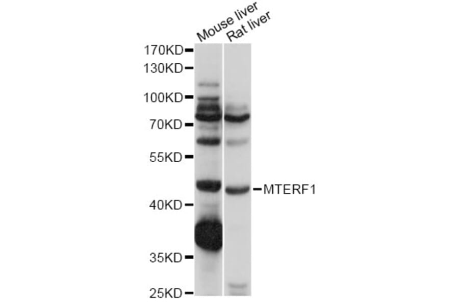 Western Blot - Anti-MTERF Antibody (A14805) - Antibodies.com