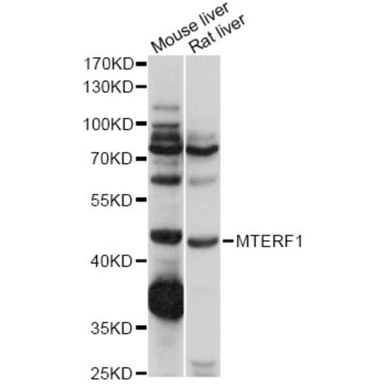Western Blot - Anti-MTERF Antibody (A14805) - Antibodies.com