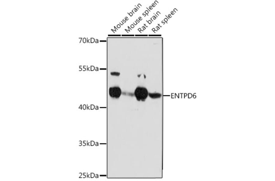 Western Blot - Anti-ENTPD6 Antibody (A89997) - Antibodies.com