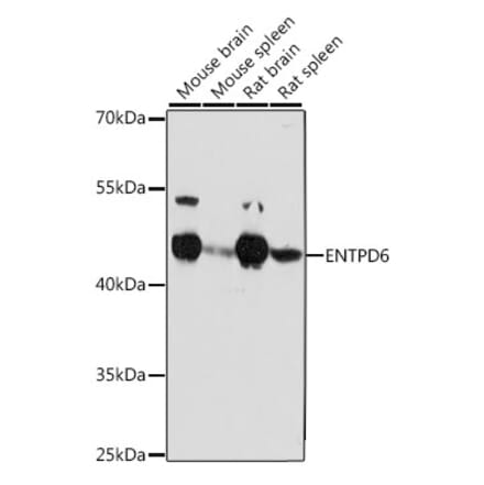 Western Blot - Anti-ENTPD6 Antibody (A89997) - Antibodies.com
