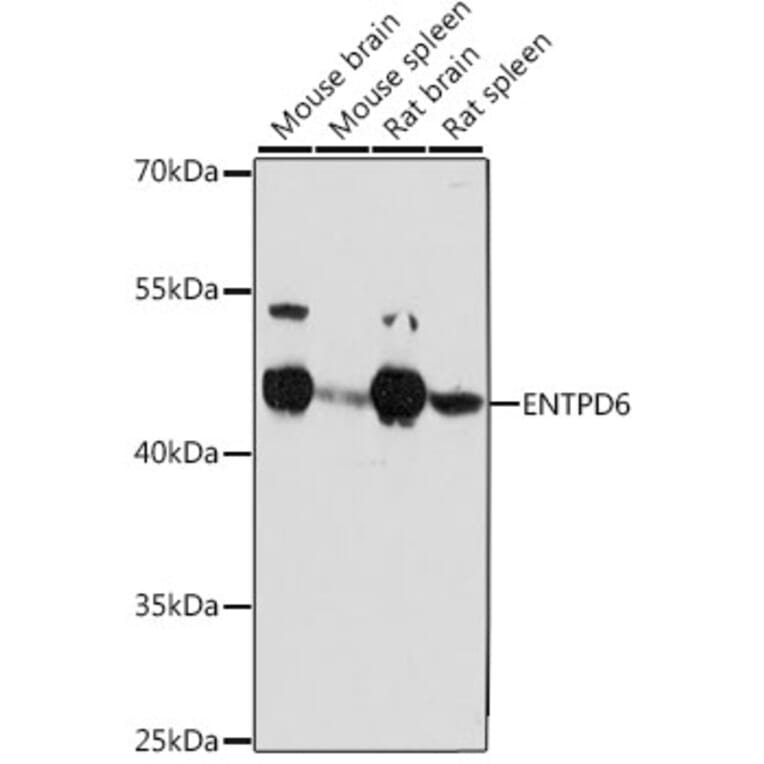 Western Blot - Anti-ENTPD6 Antibody (A89997) - Antibodies.com