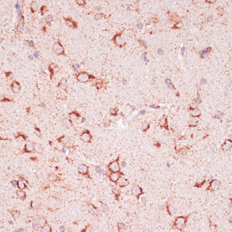 Immunohistochemistry - Anti-ENTPD6 Antibody (A89997) - Antibodies.com