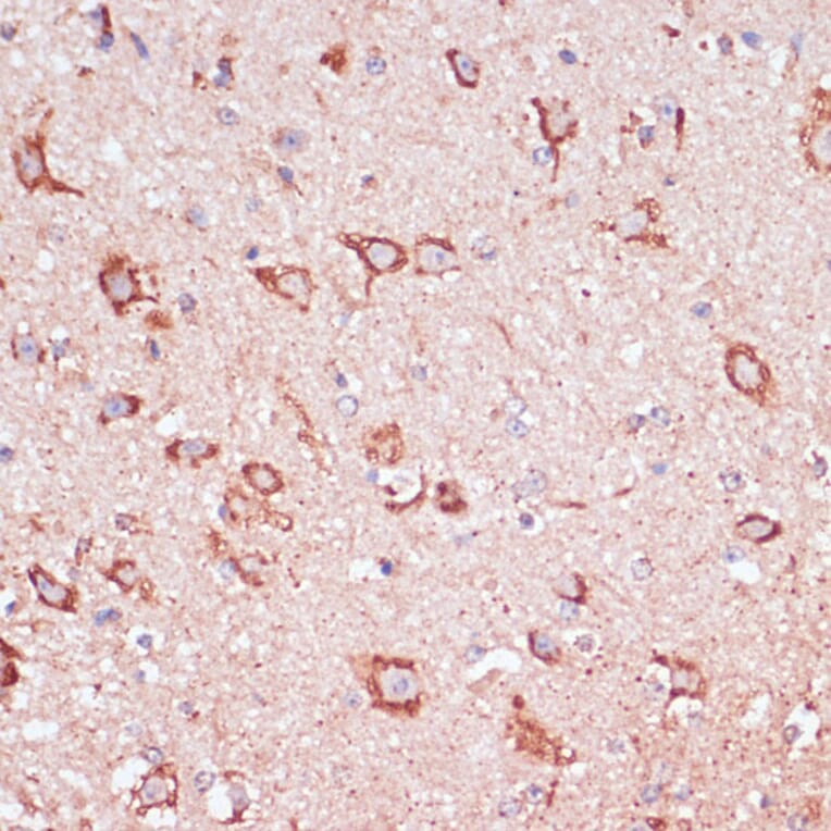 Immunohistochemistry - Anti-ENTPD6 Antibody (A89997) - Antibodies.com