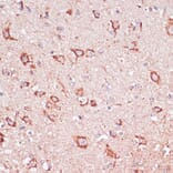 Immunohistochemistry - Anti-ENTPD6 Antibody (A89997) - Antibodies.com