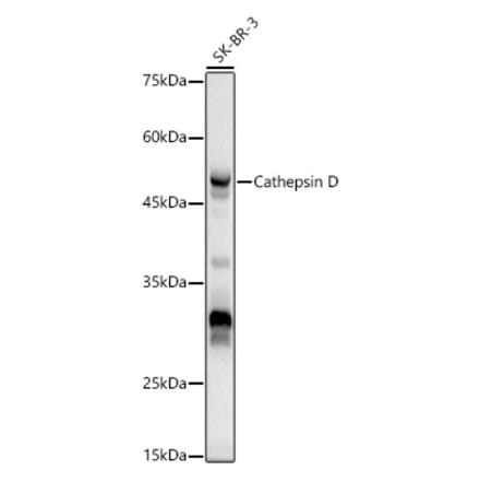Western Blot - Anti-Cathepsin D Antibody (A89998) - Antibodies.com