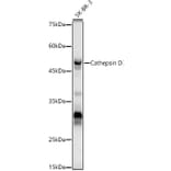 Western Blot - Anti-Cathepsin D Antibody (A89998) - Antibodies.com