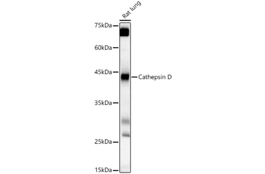 Western Blot - Anti-Cathepsin D Antibody (A89998) - Antibodies.com