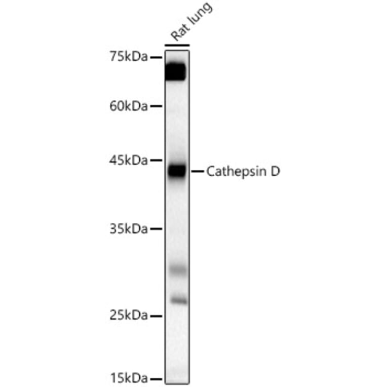 Western Blot - Anti-Cathepsin D Antibody (A89998) - Antibodies.com