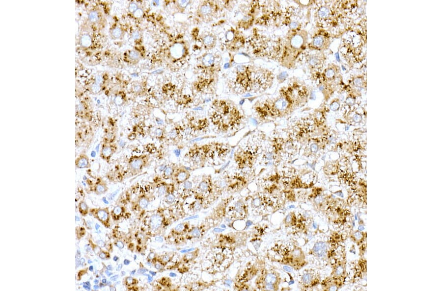 Immunohistochemistry - Anti-Cathepsin D Antibody (A89998) - Antibodies.com