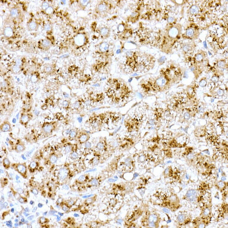 Immunohistochemistry - Anti-Cathepsin D Antibody (A89998) - Antibodies.com