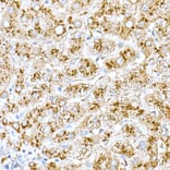 Immunohistochemistry - Anti-Cathepsin D Antibody (A89998) - Antibodies.com
