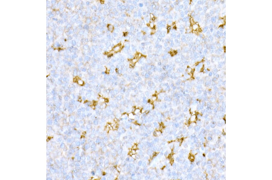 Immunohistochemistry - Anti-Cathepsin D Antibody (A89998) - Antibodies.com
