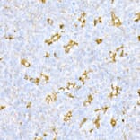 Immunohistochemistry - Anti-Cathepsin D Antibody (A89998) - Antibodies.com