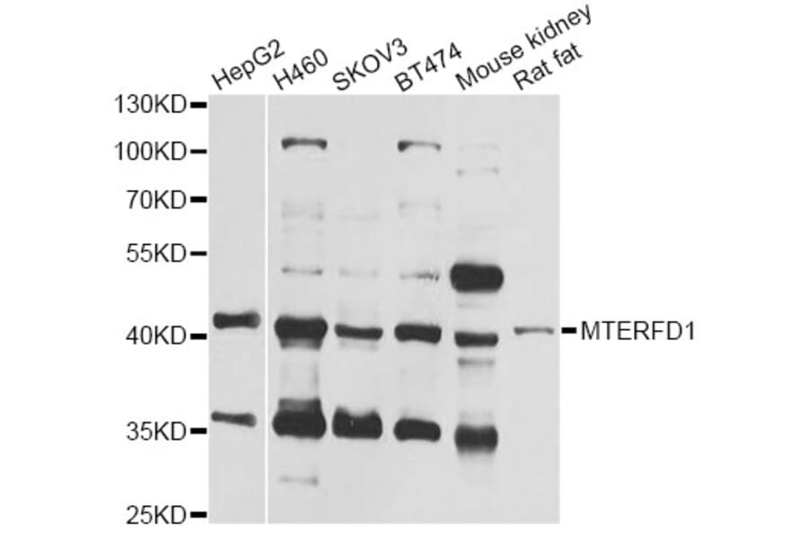 Western Blot - Anti-MTERFD1 Antibody (A12585) - Antibodies.com