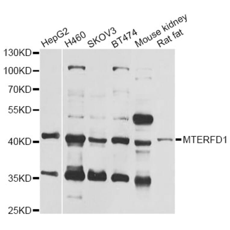 Western Blot - Anti-MTERFD1 Antibody (A12585) - Antibodies.com
