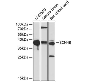 Western Blot - Anti-SCN4B Antibody (A9000) - Antibodies.com