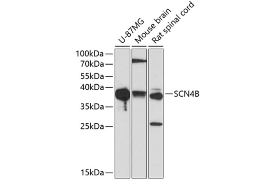 Western Blot - Anti-SCN4B Antibody (A9000) - Antibodies.com