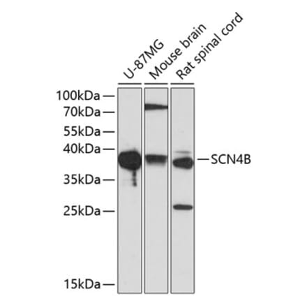 Western Blot - Anti-SCN4B Antibody (A9000) - Antibodies.com